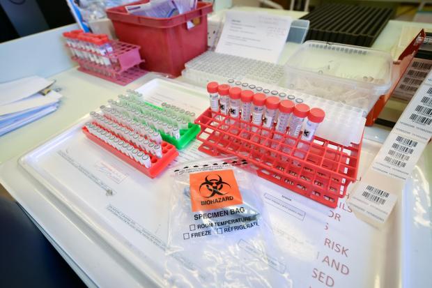 The National: Coronavirus test samples in lab