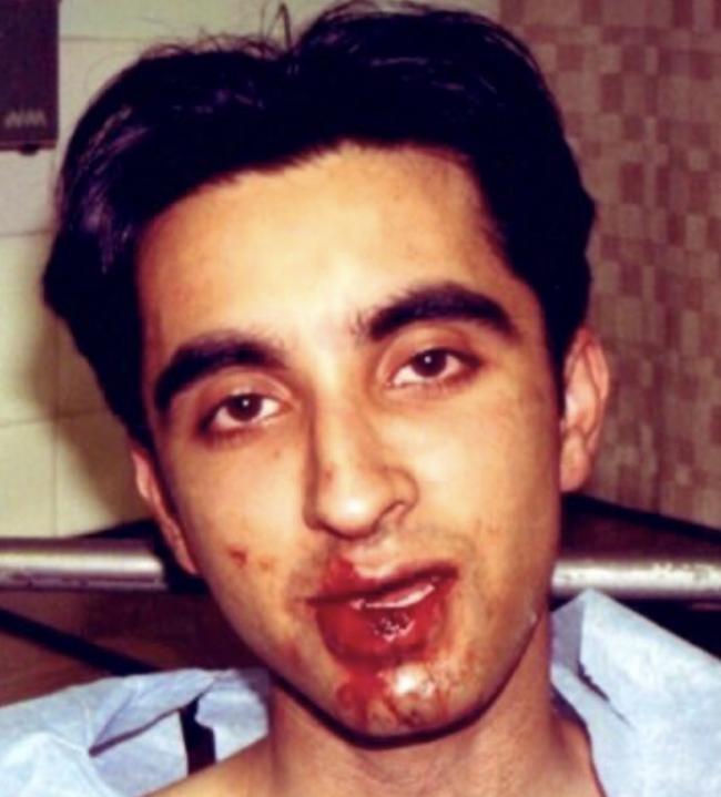 Aamer Anwar was himself a victim of police brutality in Glasgow
