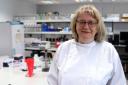 Zosia Miedzybrodzka, professor of medical genetics at the University of Aberdeen and director of the NHS North of Scotland Genetic Service, led the research