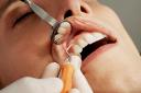 The number of NHS dentists in Fife has gone down since the pandemic.