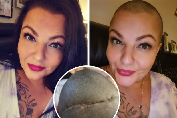 Mum who had 10-inch tumour removed from skull raises £2.5k for medics who 'saved her life'